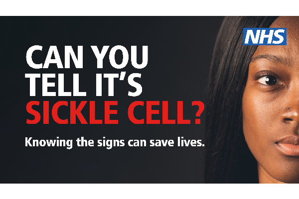 Can you tell it's sickle cell? Knowing the signs can save lives.